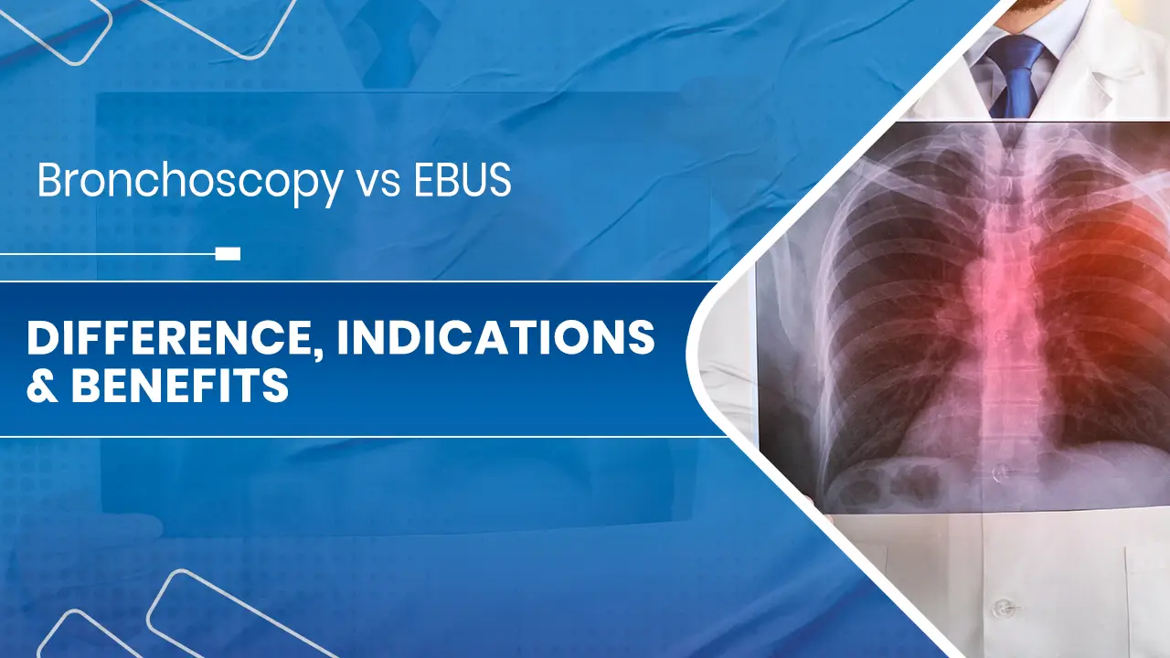 Bronchoscopy vs EBUS.jpg