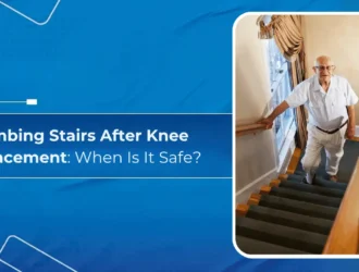 Climbing Stairs After Knee Replacement: When Is It Safe