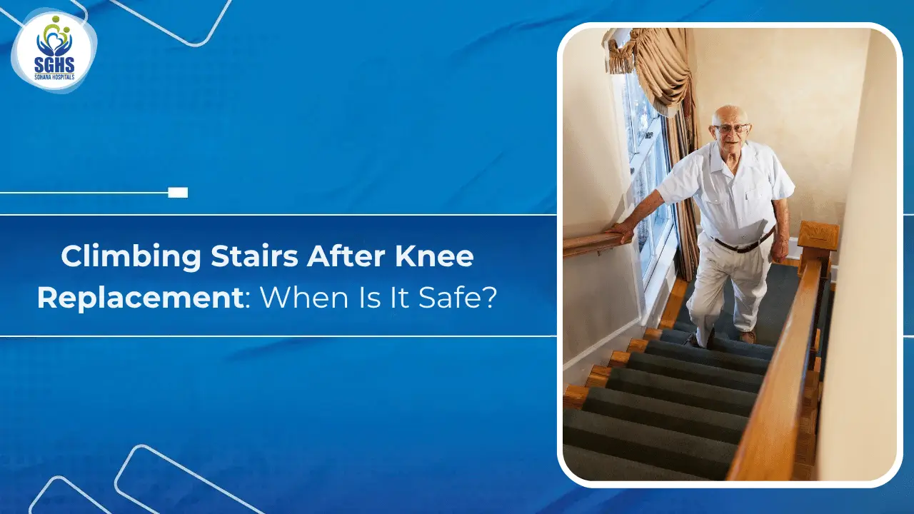 Climbing Stairs After Knee Replacement: When Is It Safe