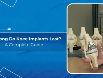 How Long Do Knee Implants Last