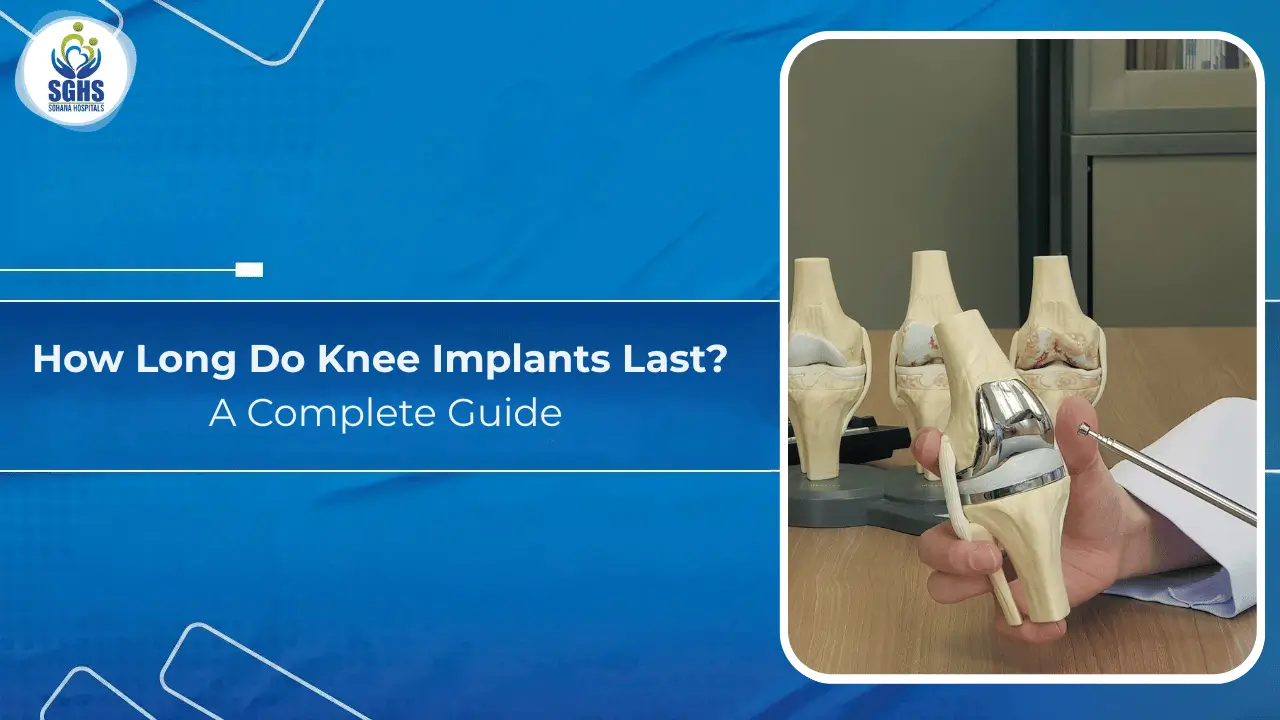 How Long Do Knee Implants Last