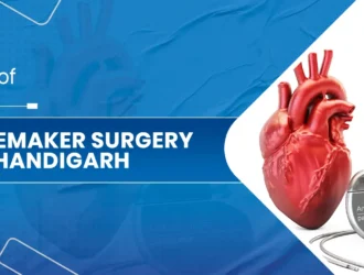 Pacemaker Surgery in Chandigarh.jpg