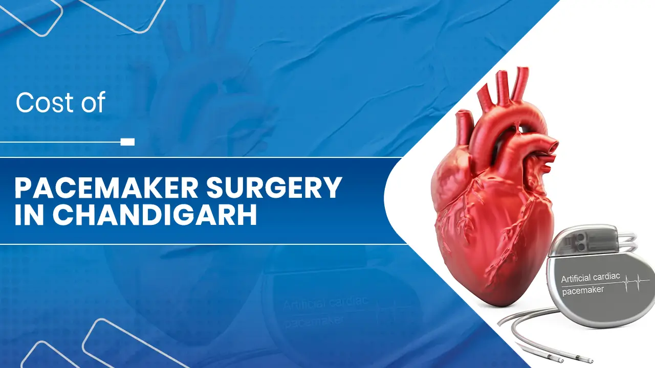Pacemaker Surgery in Chandigarh.jpg