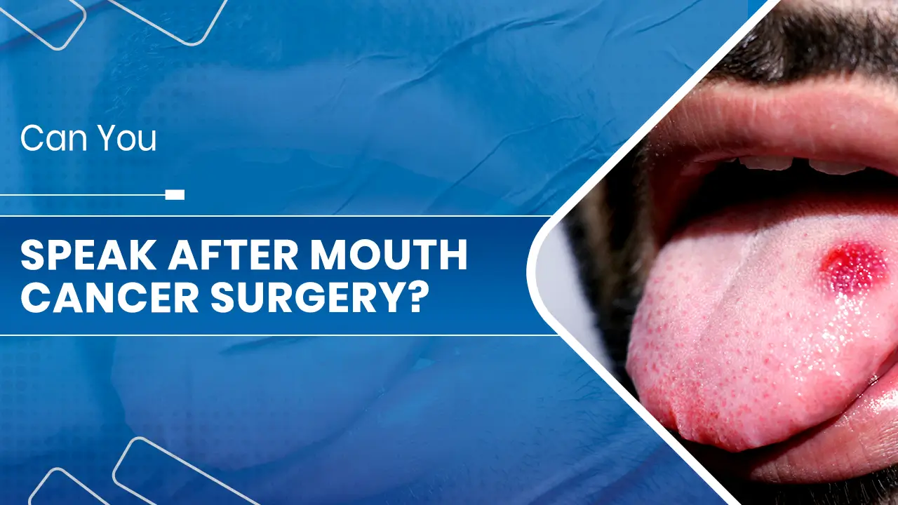 Speak After Mouth Cancer Surgery.jpg