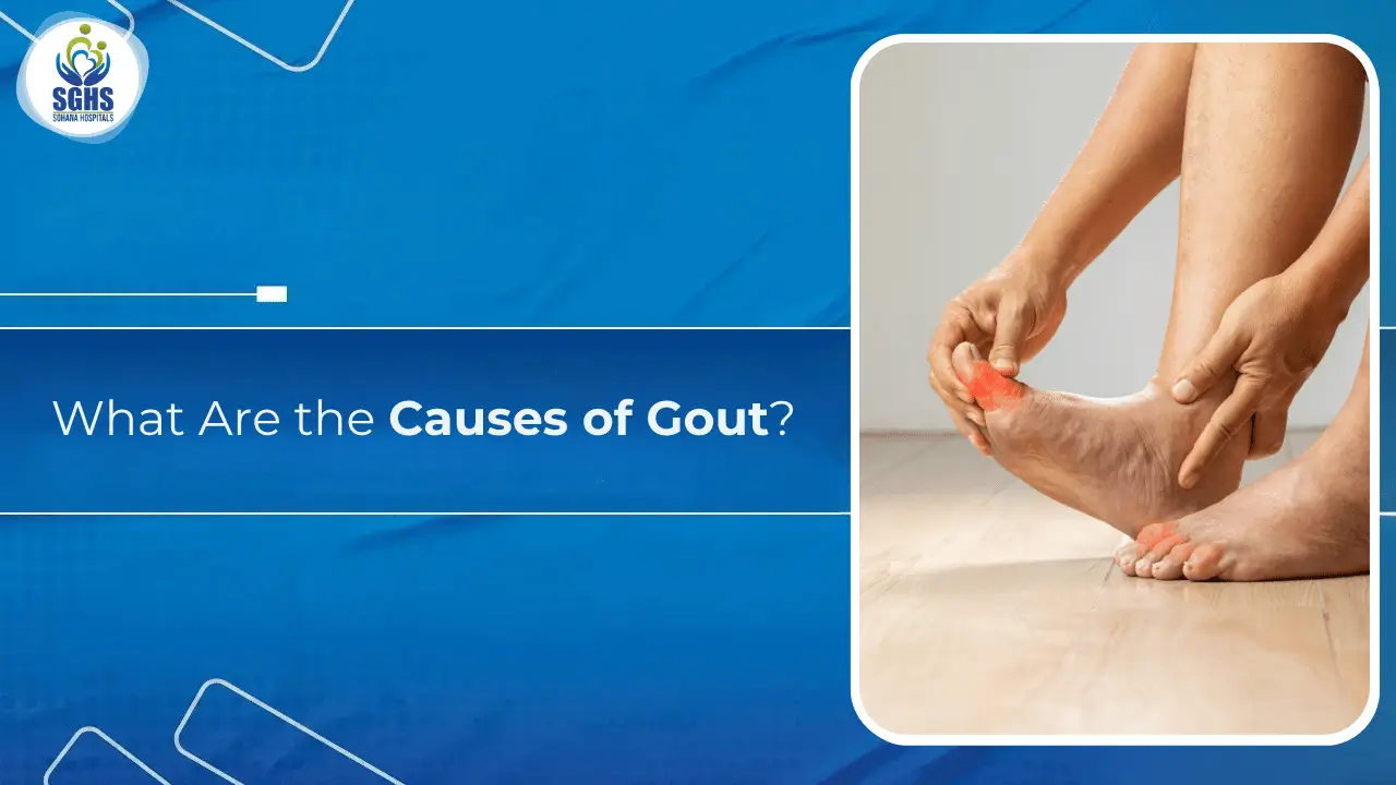 What Are the Causes of Gout