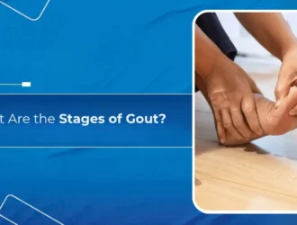 What Are the Stages of Gout
