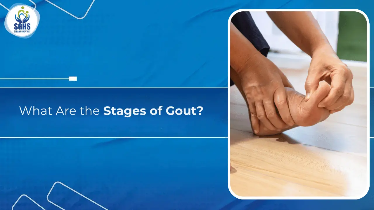 What Are the Stages of Gout