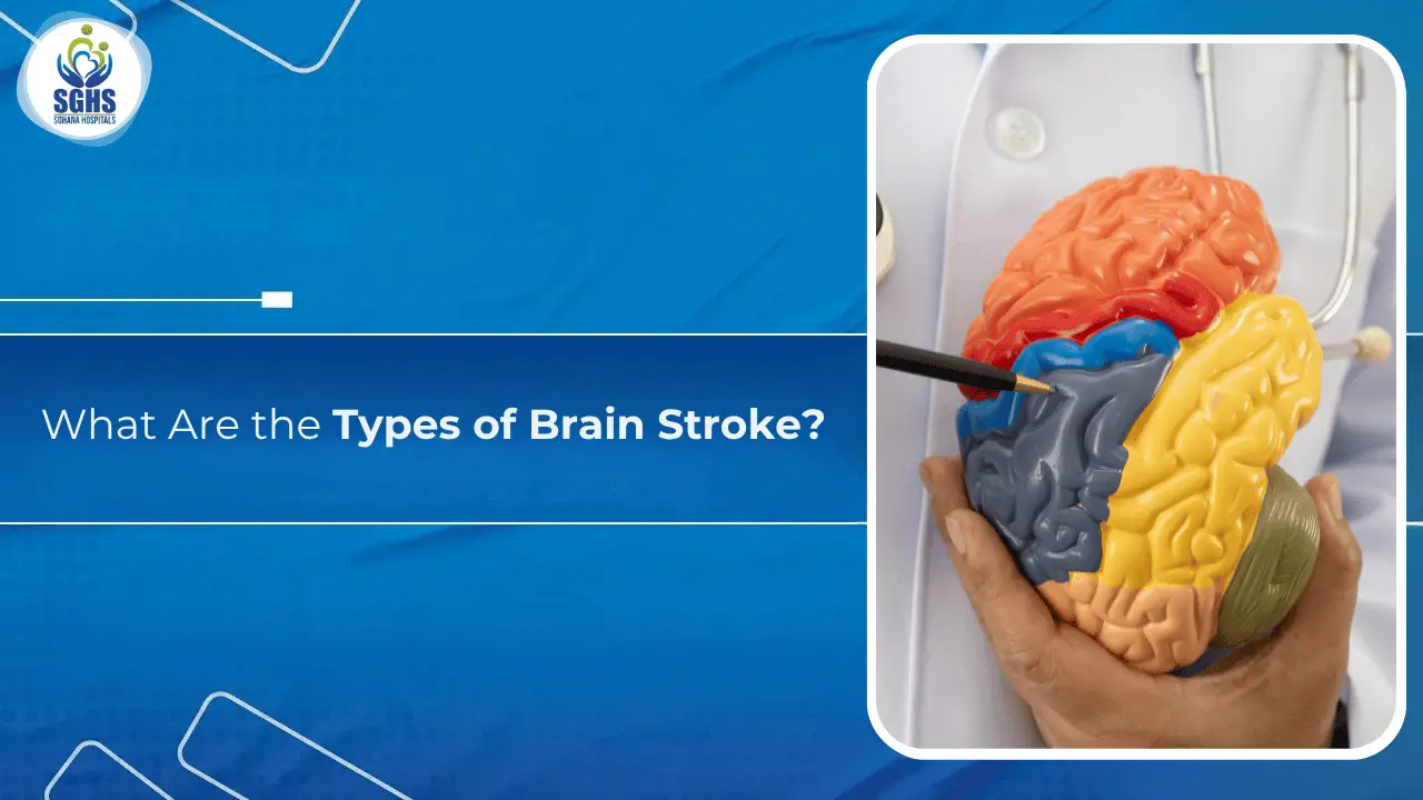 What Are the Types of Brain Stroke