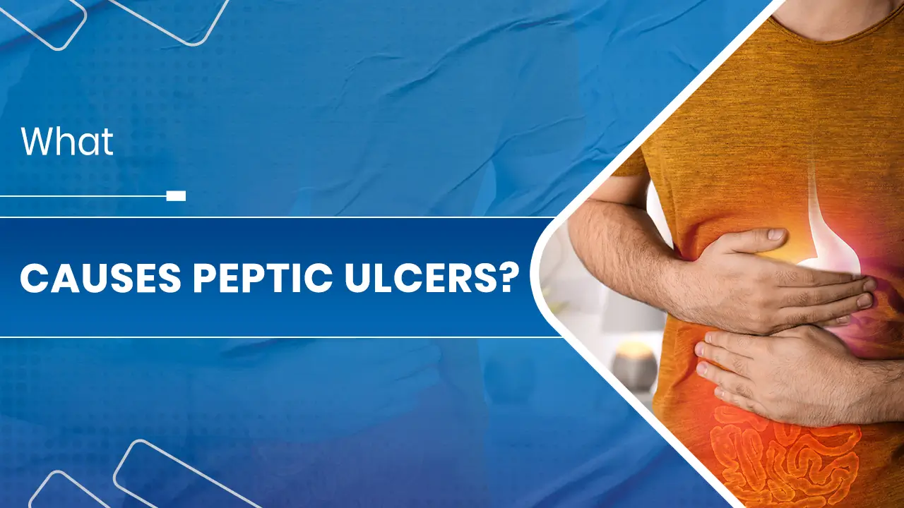Peptic Ulcers