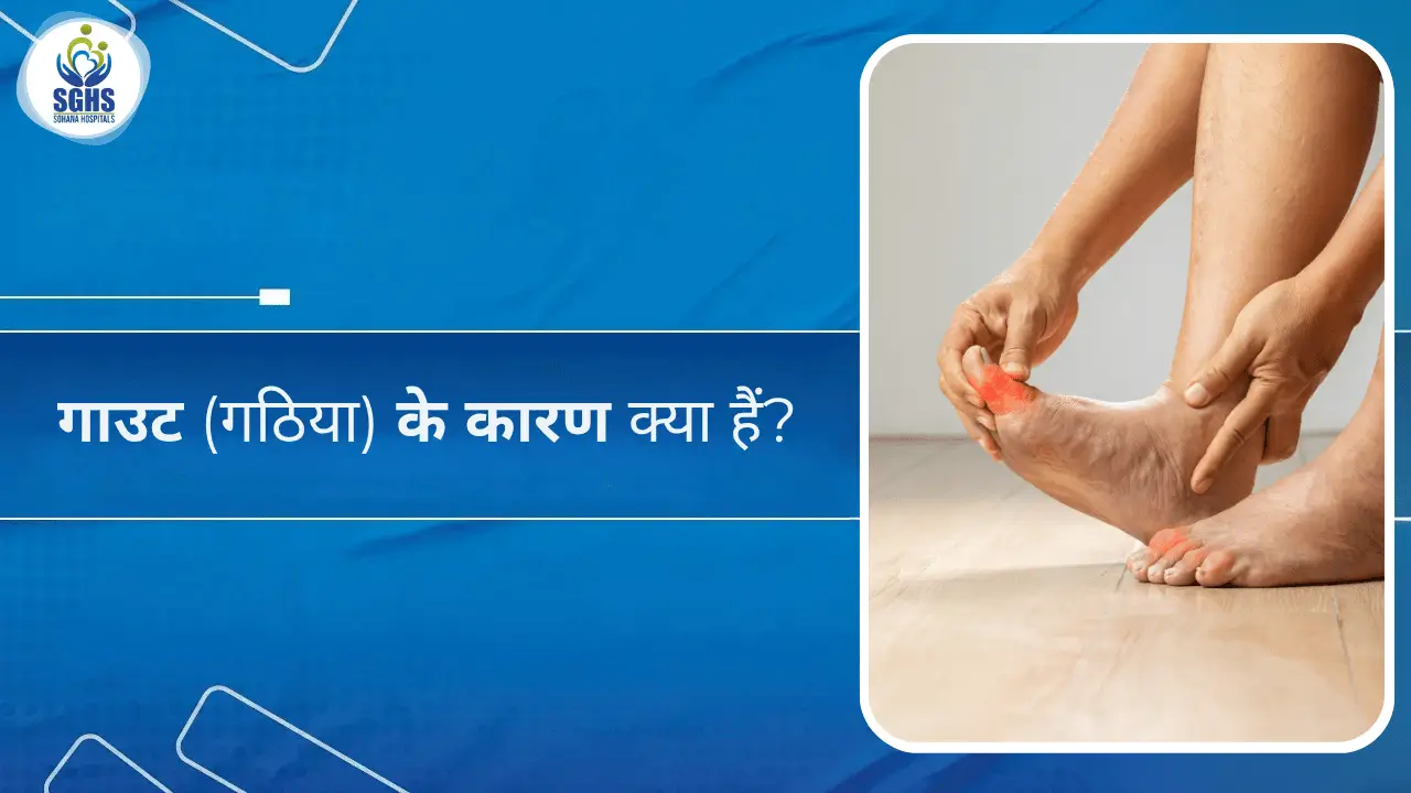 गाउट (गठिया) के कारण क्या हैं