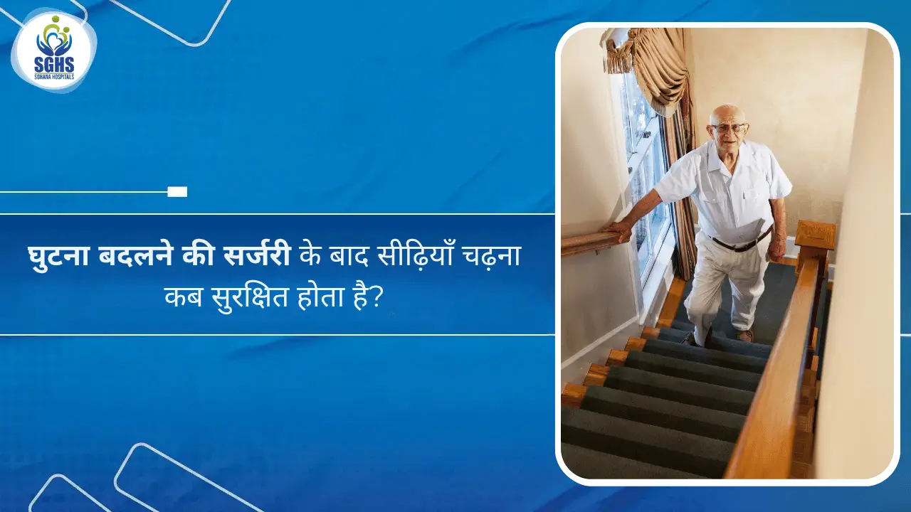 घुटना बदलने की सर्जरी के बाद सीढ़ियाँ चढ़ना कब सुरक्षित होता है