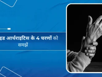 रूमेटाइड आर्थराइटिस के 4 चरणों को समझें