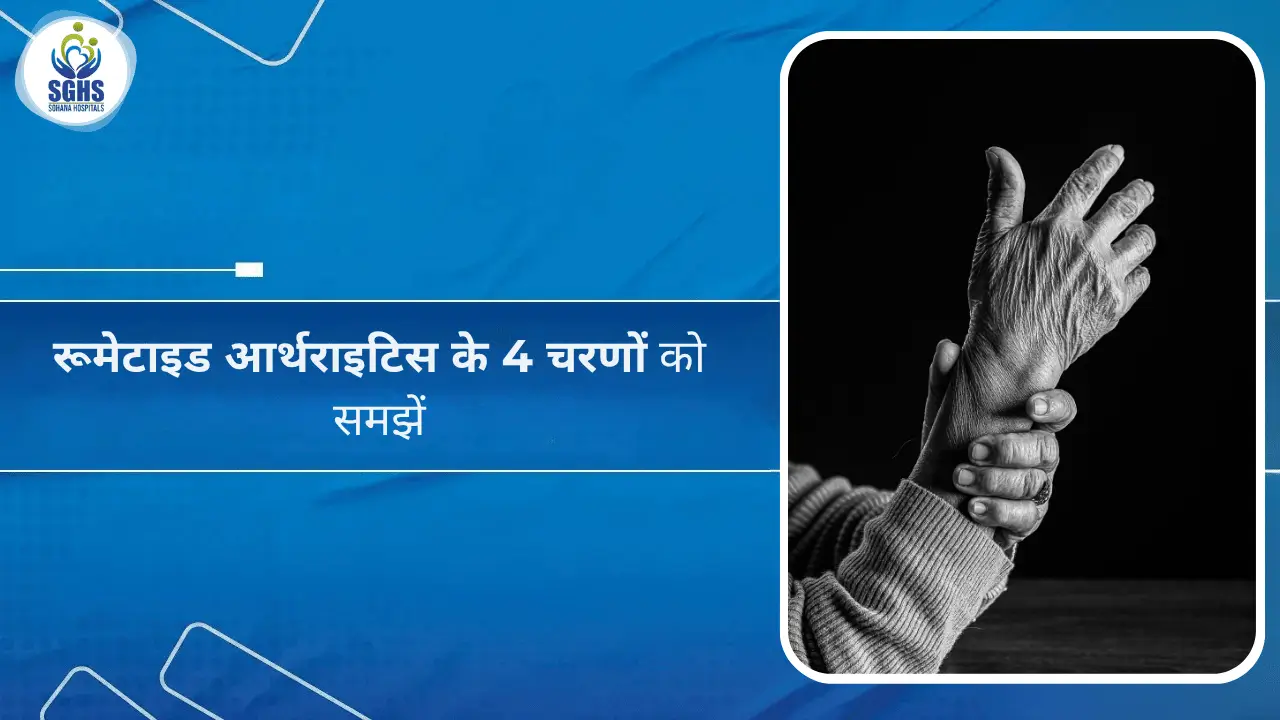 रूमेटाइड आर्थराइटिस के 4 चरणों को समझें