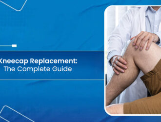 kneecap replacement