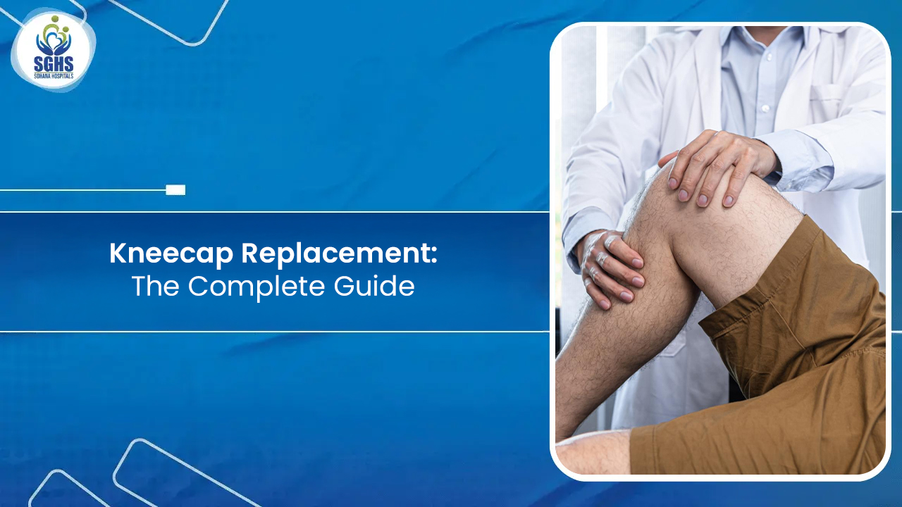kneecap replacement