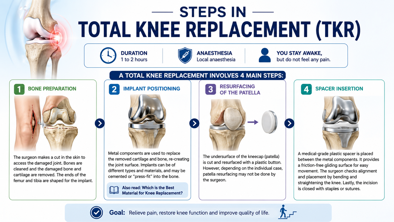 Steps in Total Knee Replacement (TKR) Surgery