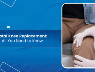 Total Knee Replacement: All You Need to Know