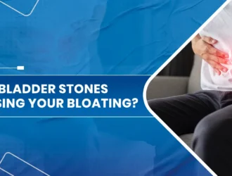 Are Gallbladder Stones