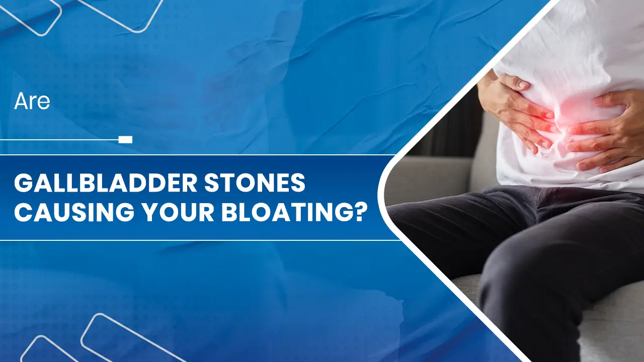 Are Gallbladder Stones