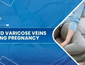 Avoid Varicose Veins During Pregnancy