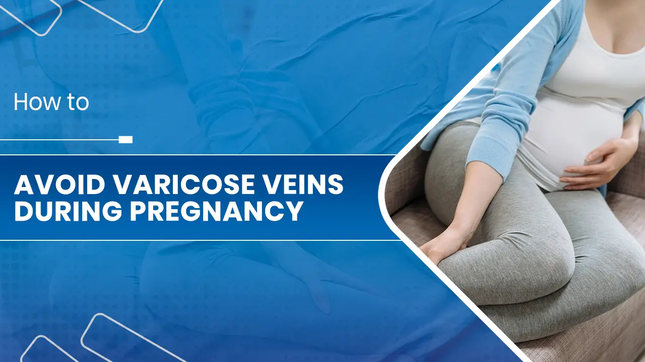 Avoid Varicose Veins During Pregnancy