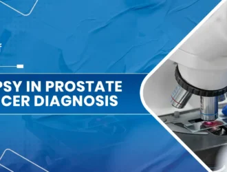 Biopsy in Prostate Cancer Diagnosis.jpg