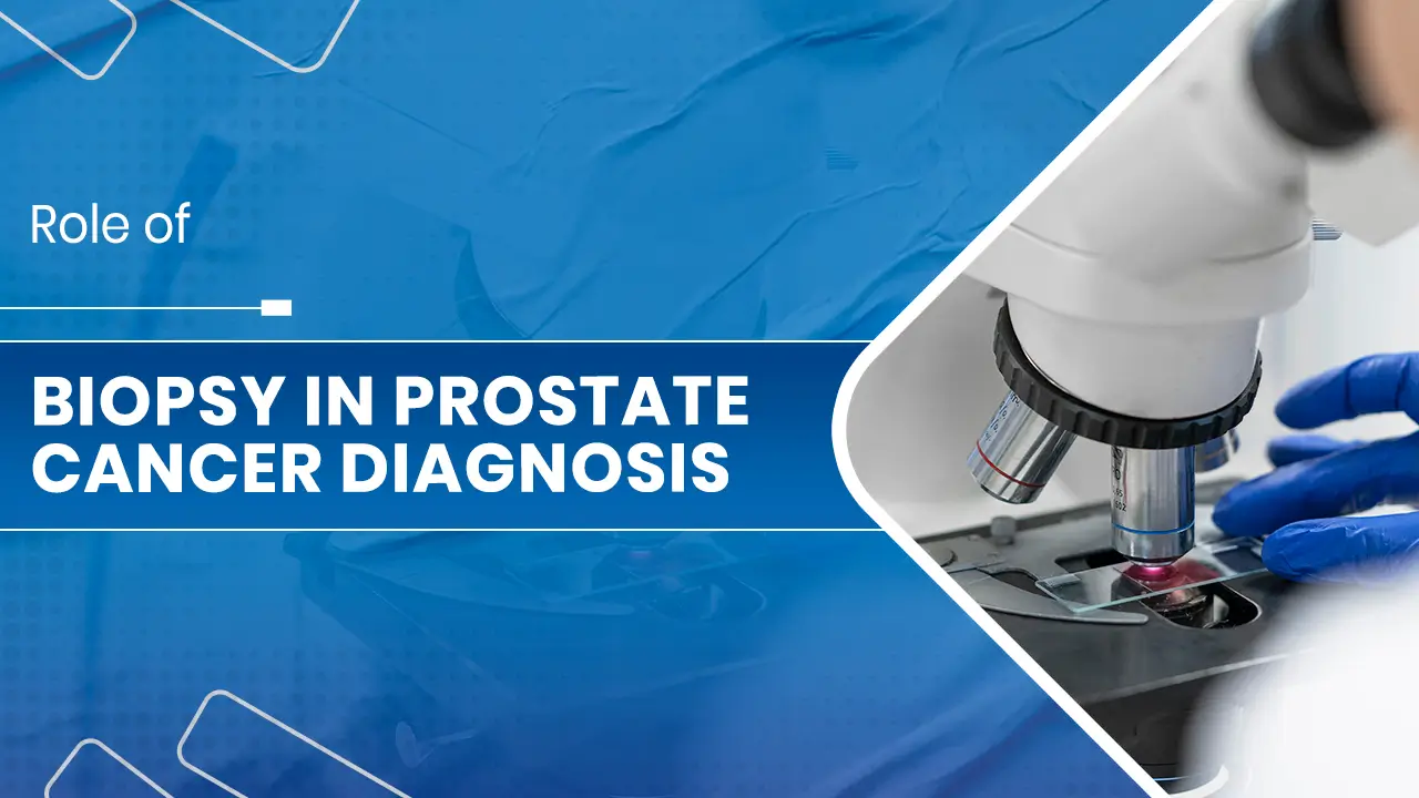 Biopsy in Prostate Cancer Diagnosis.jpg