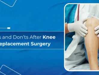 Do’s and Don’ts After Knee Replacement Surgery