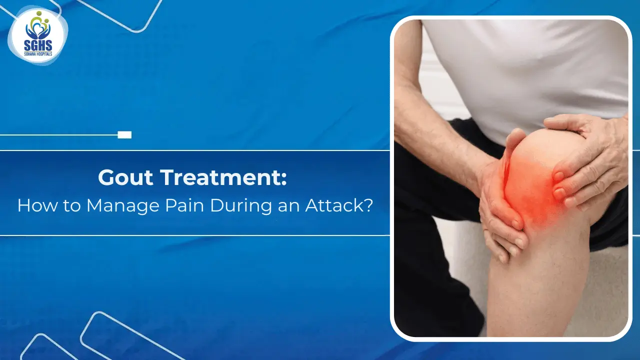 Gout Treatment: How to Manage Pain During an Attack