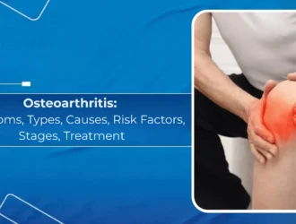 Osteoarthritis: Symptoms, Types, Causes, Risk Factors, Stages, Treatment
