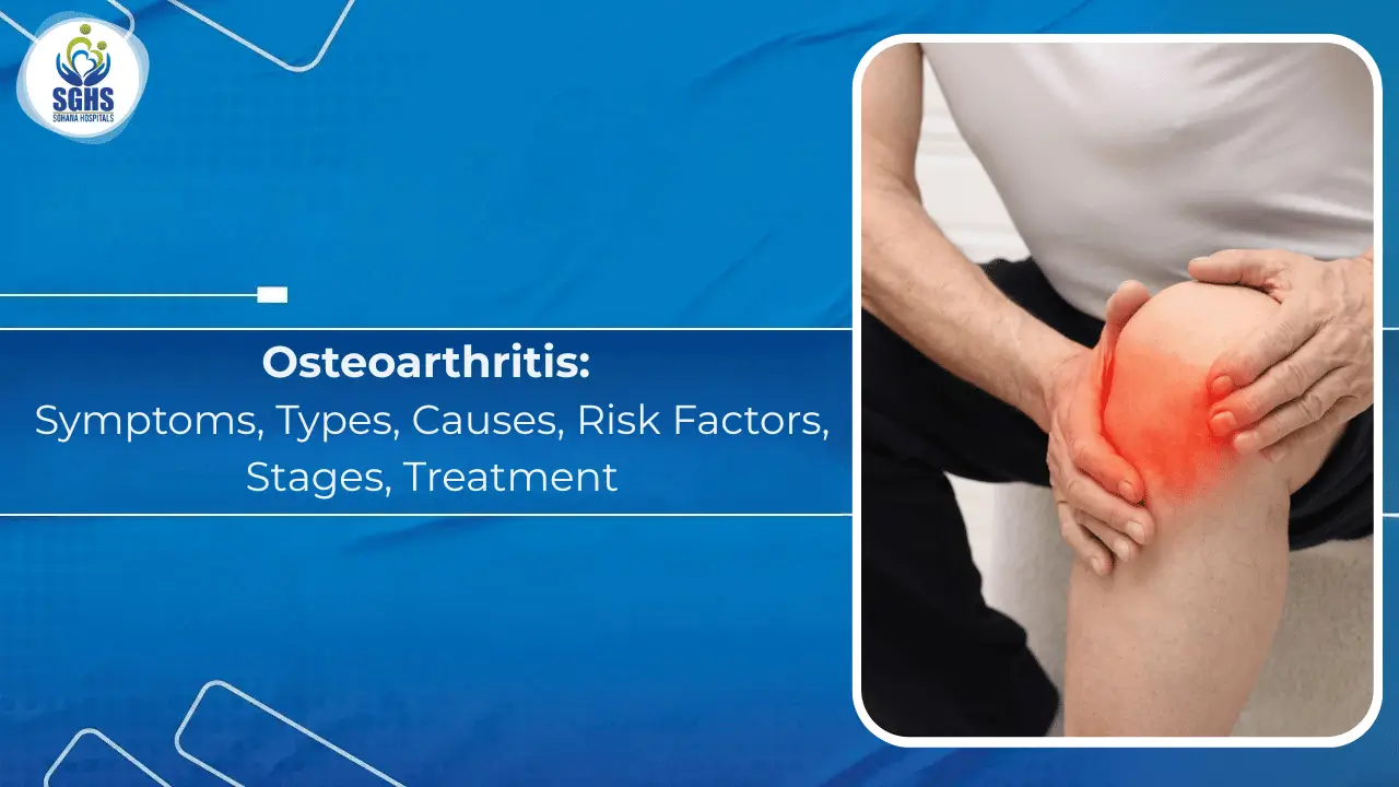 Osteoarthritis: Symptoms, Types, Causes, Risk Factors, Stages, Treatment