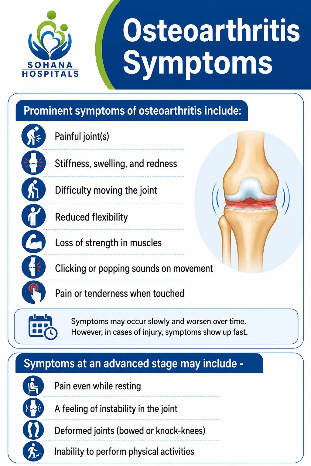 Osteoarthritis Symptoms