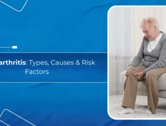 Osteoarthritis: Types, Causes & Risk Factors