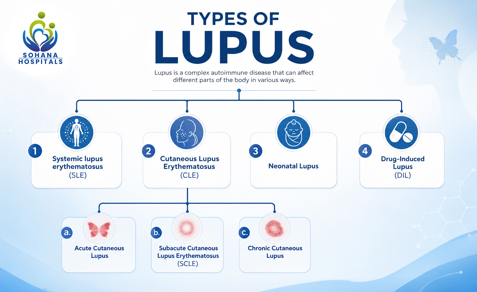 Different Types of Lupus