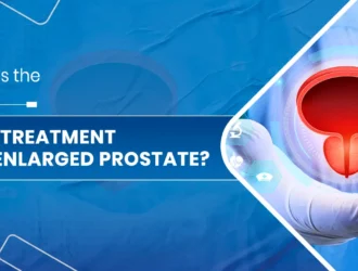 Best Treatment for Enlarged Prostate