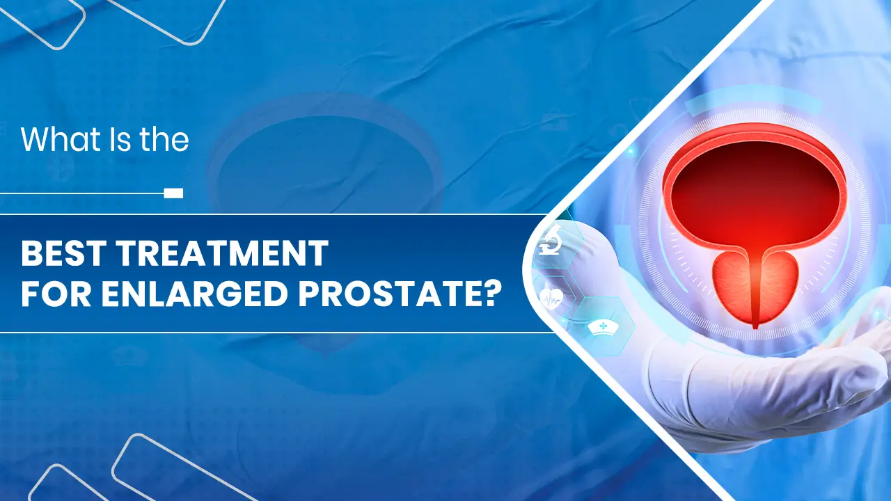 Best Treatment for Enlarged Prostate