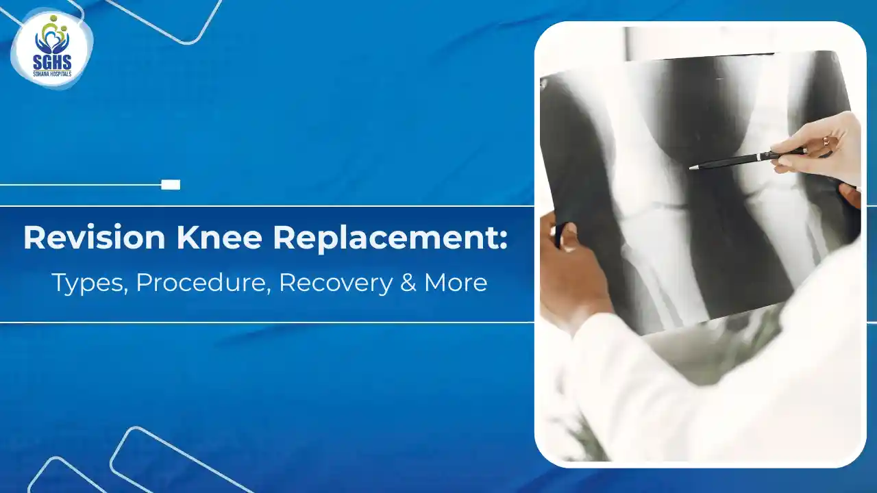 Revision Knee Replacement Types, Procedure, Recovery & More