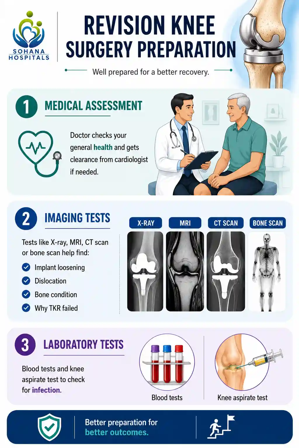 Revision Knee Surgery Preparation