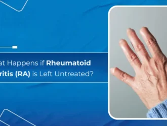 What Happens if Rheumatoid Arthritis (RA) is Left Untreated