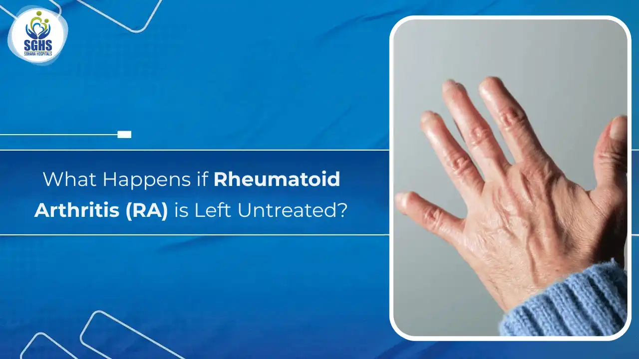 What Happens if Rheumatoid Arthritis (RA) is Left Untreated