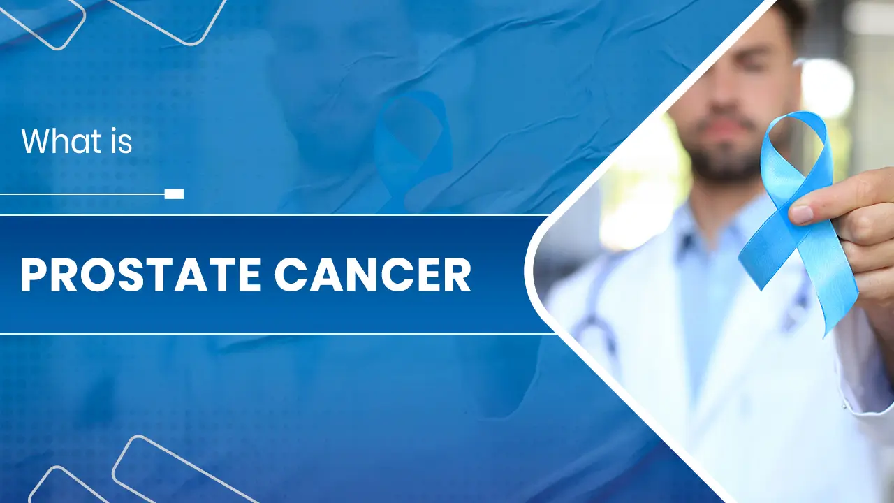 What is Prostate Cancer.jpg