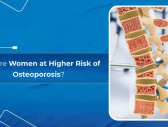 Why Are Women at Higher Risk of Osteoporosis