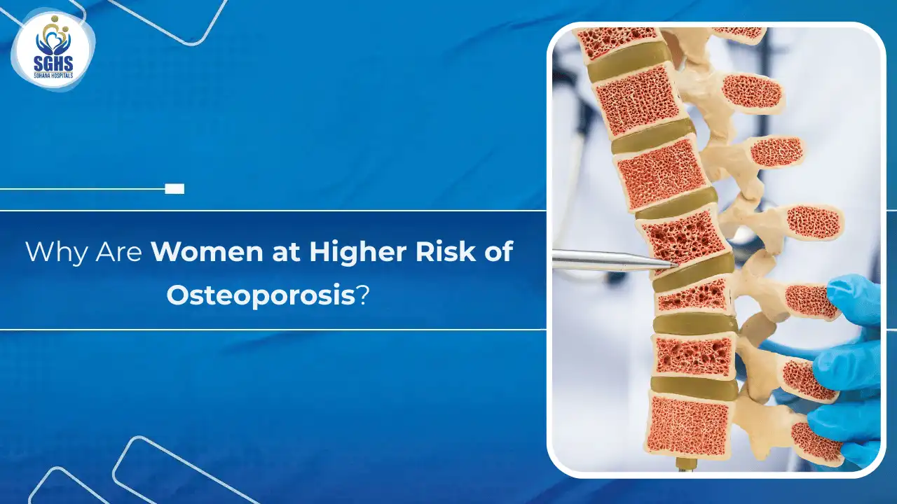 Why Are Women at Higher Risk of Osteoporosis