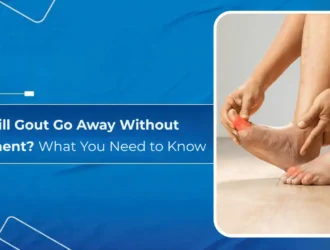 Will Gout Go Away Without Treatment