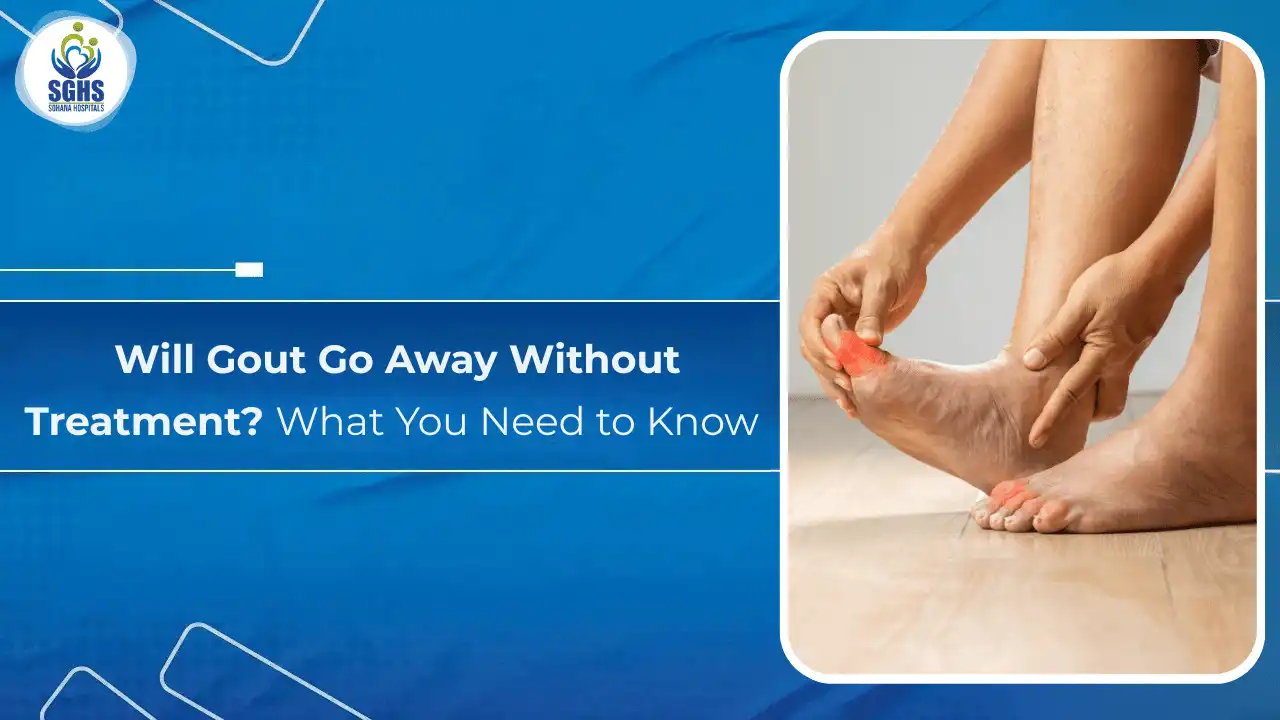Will Gout Go Away Without Treatment