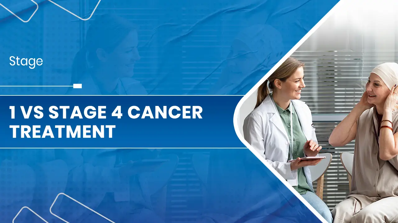 1 vs Stage 4 Cancer Treatment