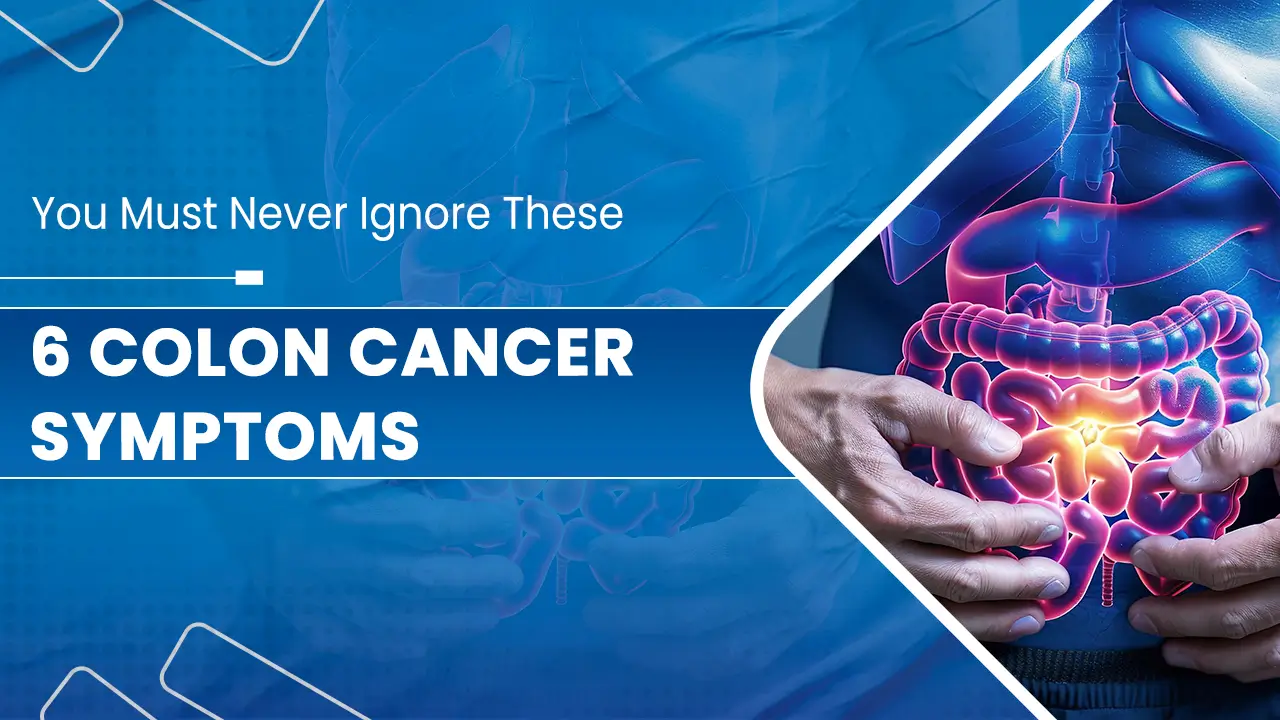6 Colon Cancer Symptoms.jpg