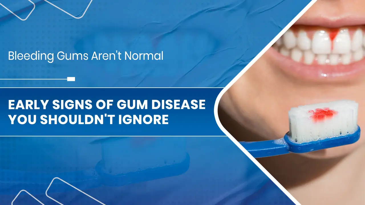 Bleeding Gums Aren't Normal