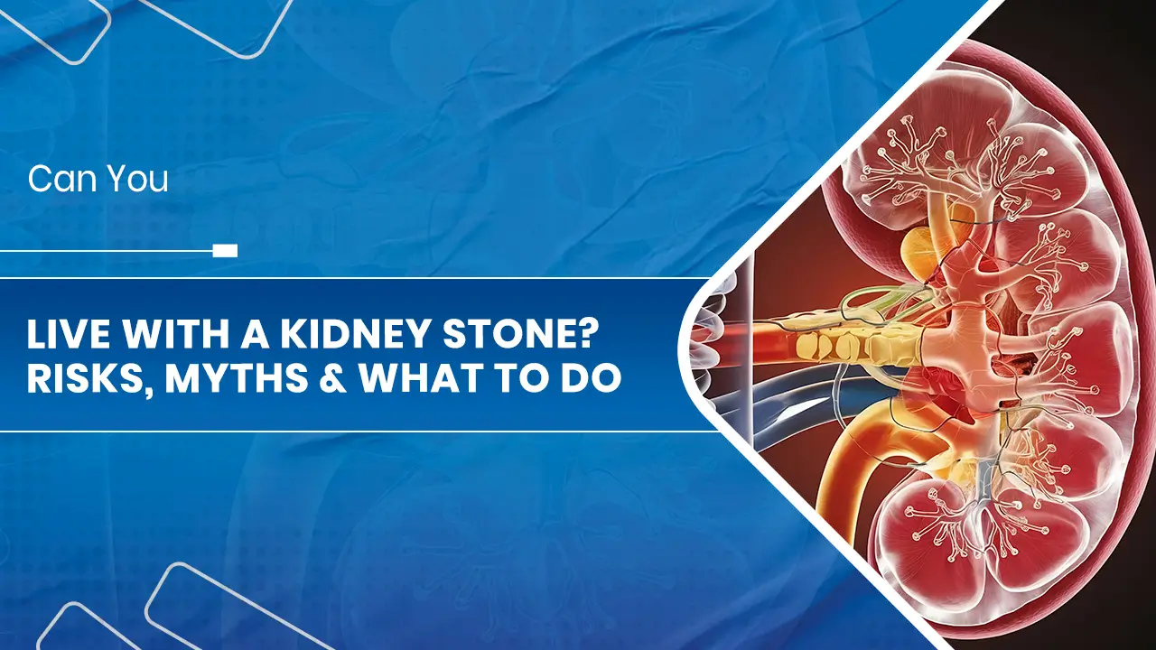 Kidney Stone Treatment