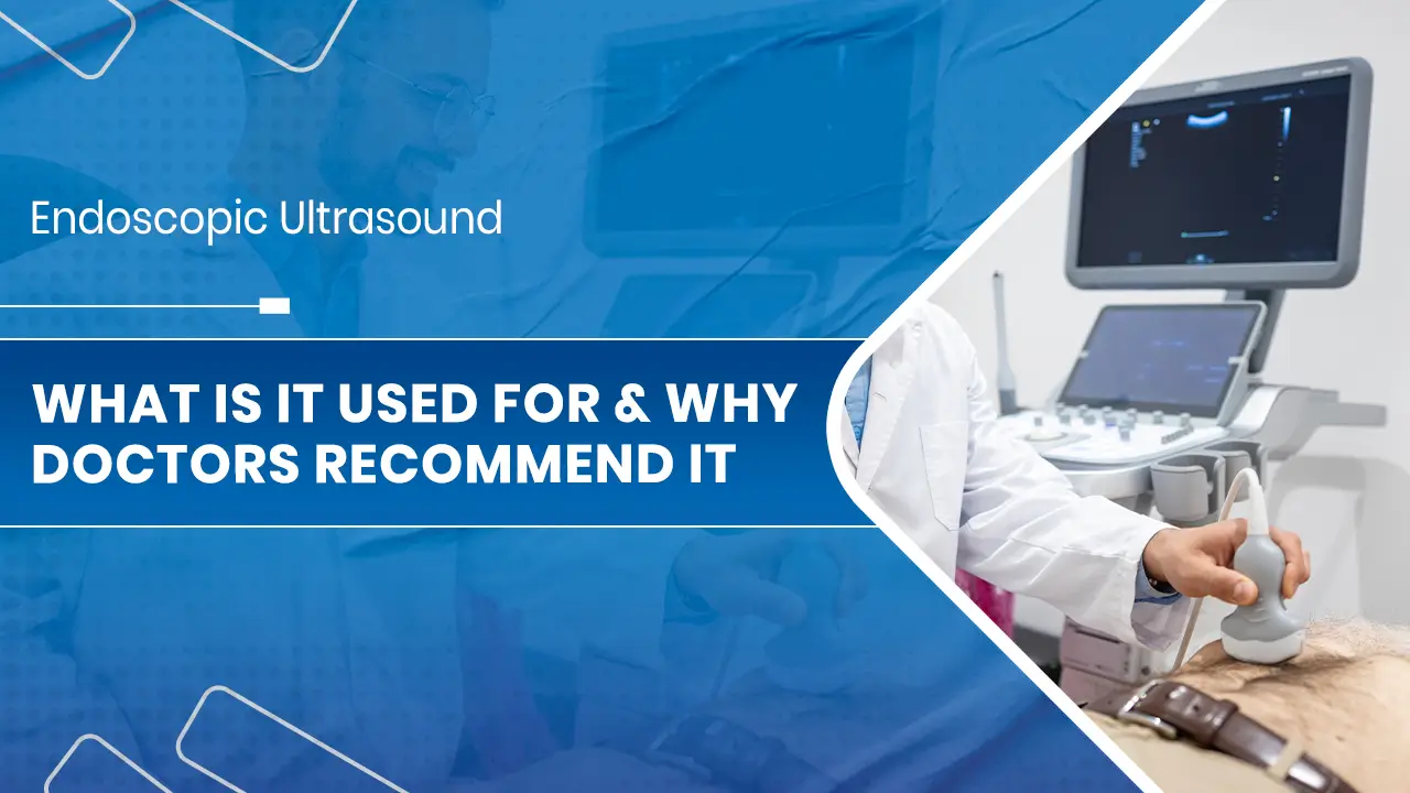 Endoscopic Ultrasound